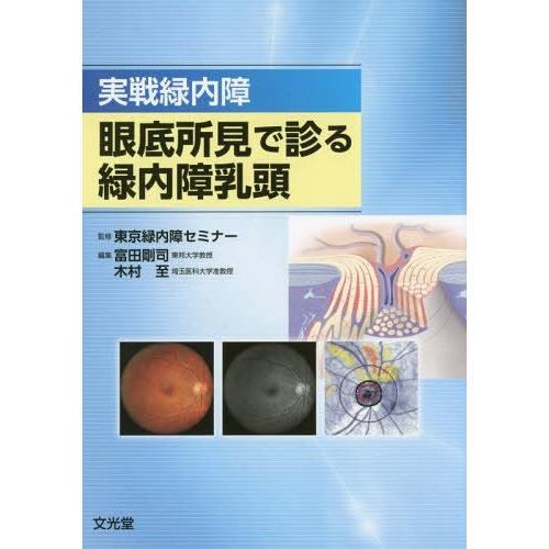 【送料無料】[本/雑誌]/実戦緑内障眼底所見で診る緑内障乳頭/東京緑内障セミナ監修 富田剛司/編集 ...