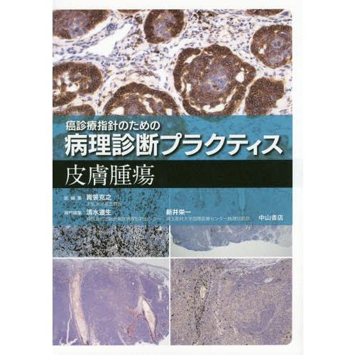 【送料無料】[本/雑誌]/皮膚腫瘍 (癌診療指針のための病理診断プラクティス)/清水道生/専門編集 ...