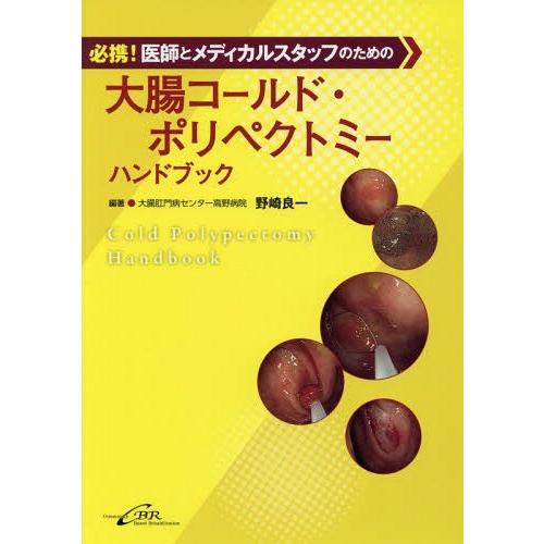 【送料無料】[本/雑誌]/大腸コールド・ポリペクトミーハンドブック 必携!医師とメディカルスタッフの...