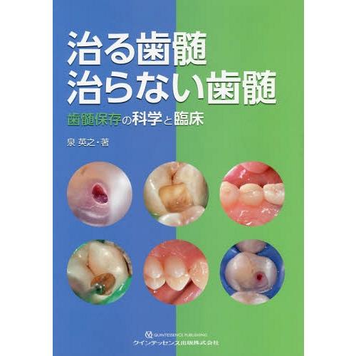 【送料無料】[本/雑誌]/治る歯髄治らない歯髄 歯髄保存の科学と臨床/泉英之/著