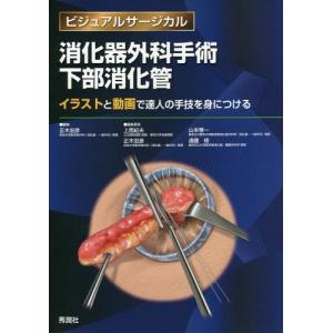 消化器外科手術下部消化管 イラストと動画で達人の手技を身につける ぐるぐる王国 スタークラブ 通販 Yahoo ショッピング