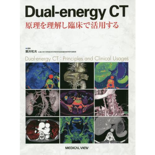 【送料無料】[本/雑誌]/Dual‐energy CT 原理を理解し臨床で活用する/粟井和夫/編集