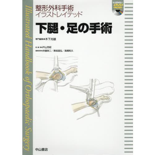 【送料無料】[本/雑誌]/下腿・足の手術 (整形外科手術イラストレイテッド)/木下光雄/専門編集