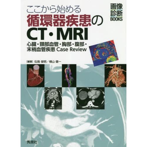 【送料無料】[本/雑誌]/ここから始める循環器疾患のCT・MRI 心臓・頸部血管・胸部・腹部・末梢血...