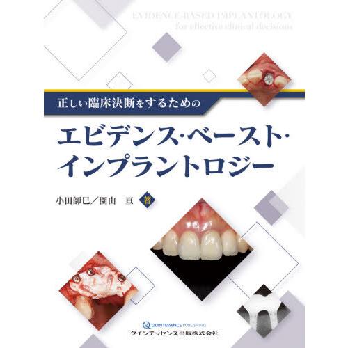 【送料無料】[本/雑誌]/正しい臨床決断をするためのエビデンス・ベースト・インプラントロジー/小田師...