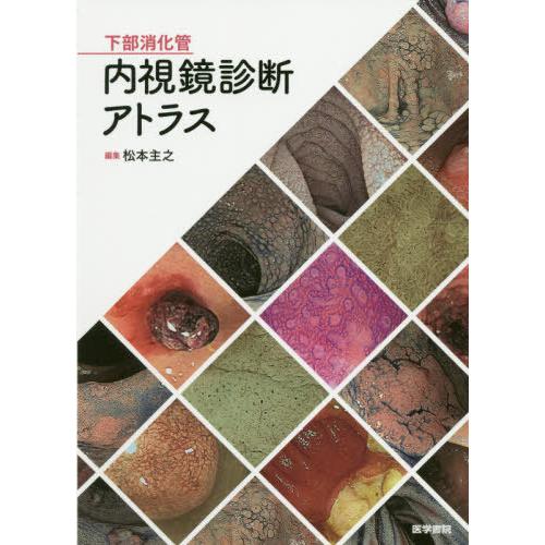【送料無料】[本/雑誌]/下部消化管内視鏡診断アトラス/松本主之/編集