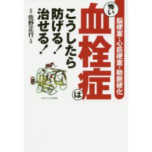 [書籍のゆうメール同梱は2冊まで]/[本/雑誌]/怖い血栓症はこうしたら防げる!治せる!