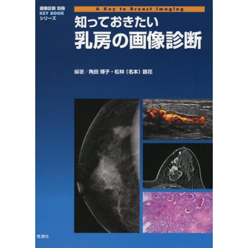 【送料無料】[本/雑誌]/知っておきたい乳房の画像診断 (画像診断別冊KEY)/角田博子/編著 松林...