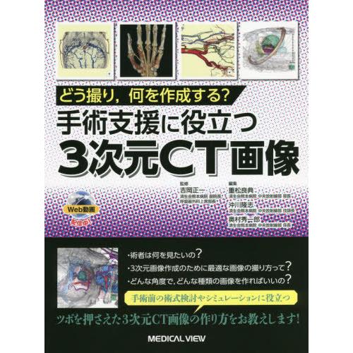 【送料無料】[本/雑誌]/どう撮り 何を作成する?手術支援に役立つ3次元CT画像/吉岡正一/監修 重...