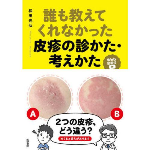 【送料無料】[本/雑誌]/誰も教えてくれなかった皮疹の診かた・考えかた Web動画付/松田光弘/著