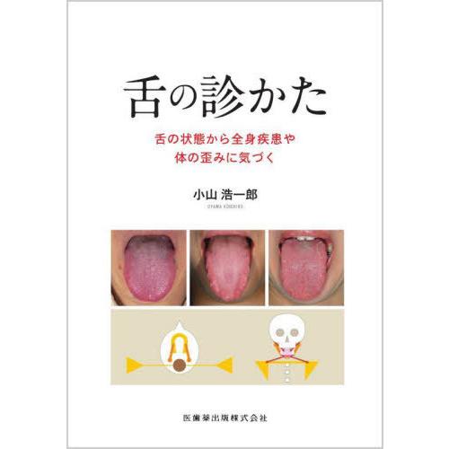 【送料無料】[本/雑誌]/舌の診かた/小山浩一郎/著