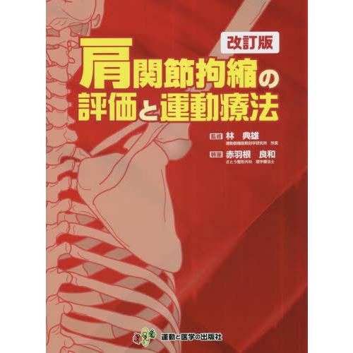 【送料無料】[本/雑誌]/肩関節拘縮の評価と運動療法/林典雄/監修 赤羽根良和/執筆