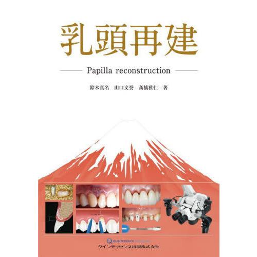 【送料無料】[本/雑誌]/乳頭再建/鈴木真名/著 山口文誉/著 高橋雅仁/著