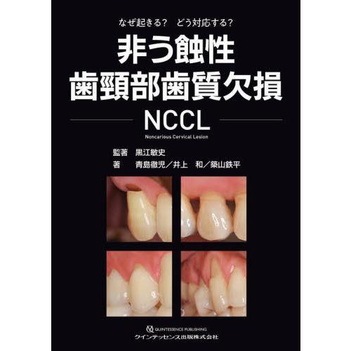 【送料無料】[本/雑誌]/非う蝕性歯頸部歯質欠損NCCL なぜ起きる?どう対応する?/黒江敏史/監著...