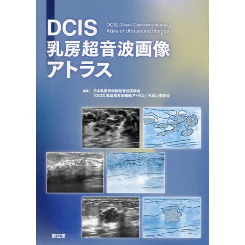 【送料無料】[本/雑誌]/DCIS乳房超音波画像アトラス/日本乳腺甲状腺超音波医学会「DCIS乳房超...