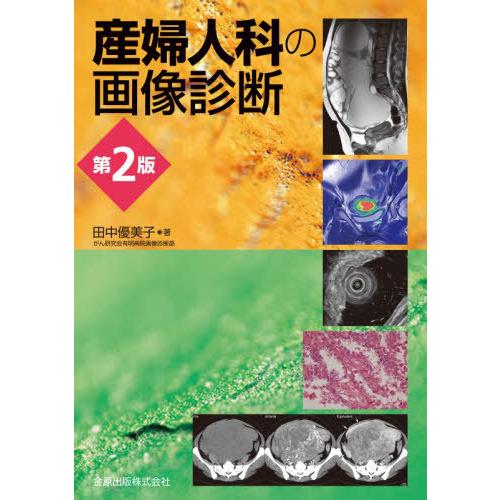【送料無料】[本/雑誌]/産婦人科の画像診断/田中優美子/著