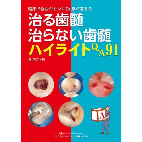 【送料無料】[本/雑誌]/治る歯髄治らない歯髄ハイライトQ&amp;A91 臨床で悩むギモンにDr.泉が答え...