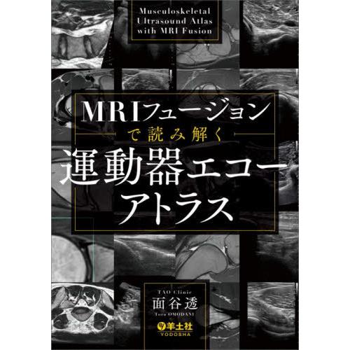 【送料無料】[本/雑誌]/MRIフュージョンで読み解く運動器エコーアトラス/面谷透/著