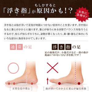 浮き指 サポーター 偏平足 外反母趾 浮指 グ...の詳細画像2