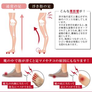 浮き指 サポーター 偏平足 外反母趾 浮指 グ...の詳細画像3