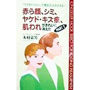 赤ら顔、シミ、ヤケド・キズ痕、肌われがきれいに消えた Part 2／木村嘉男