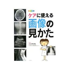 ct mri 違い 画像