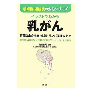 イラストでわかる乳がん／佐伯俊昭
