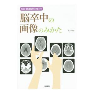 症状・経過観察に役立つ脳卒中の画像のみかた／市川博雄