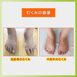 むくみとり 靴下 寝る時 グーパー体操 高齢者...の詳細画像5
