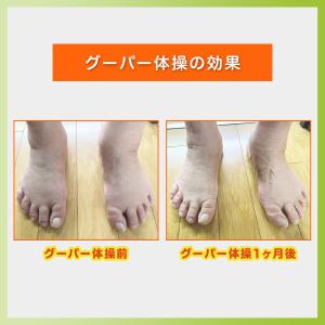 高齢者 足 むくみ 靴下 酷い 酷い グーパー...の詳細画像5