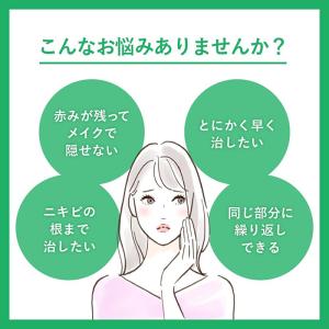 メンソレータムアクネス25メディカルクリームE...の詳細画像2