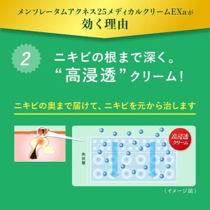 メンソレータムアクネス25メディカルクリームE...の詳細画像4