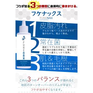 フケナックス かゆみ 頭皮 かゆい 臭い 乾燥...の詳細画像3