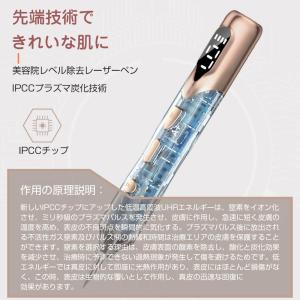 レーザーペン レーザースポットペン レーザー除...の詳細画像2