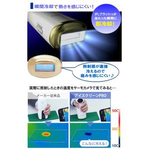 TVで紹介 アデランス DoRAISE アイス...の詳細画像3