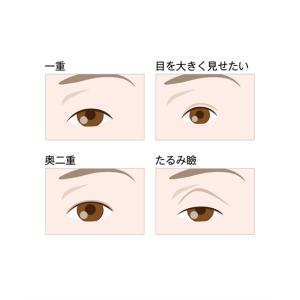 ローヤルアイムリピ R リッチモイスト 春 夏...の詳細画像3