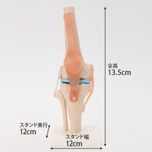 人体模型 骨格模型 膝関節 実物大 7ウェルネ...の詳細画像3