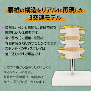 人体模型 骨格模型 腰椎 7ウェルネ 模型 実...の詳細画像4