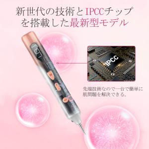 レーザーペン レーザー除去ペン 美顔レーザーペ...の詳細画像5