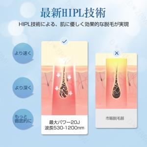 脱毛器 全身脱毛 VIO対応 だつもうき 無制...の詳細画像2