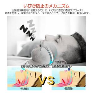 【先着順限定500円OFF】いびき防止 グッズ...の詳細画像5