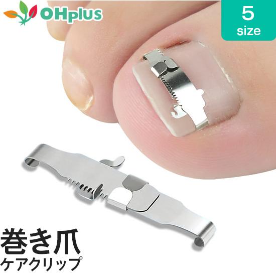 巻き爪ケアクリップ クリップワイヤーのみ ガード 爪ブロック テープ 巻きづめ 靴 巻爪 対策 足の...