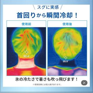 ユークール ハンズフリー氷嚢 アイスバック ネ...の詳細画像5