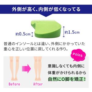 O脚矯正インソール グッズ X脚 扁平足 偏平...の詳細画像3