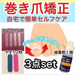 巻き爪 矯正セットプレート 爪ケア 治し方 巻き爪の治し方 自分で セルフケア 矯正 治療