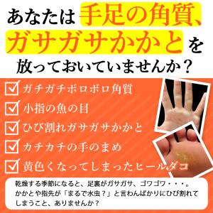 魚の目 取り方 自分で スクラッチ 角質除去 ...の詳細画像1