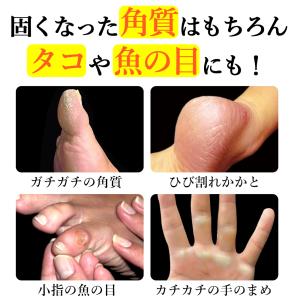 魚の目 取り方 自分で スクラッチ 角質除去 ...の詳細画像2