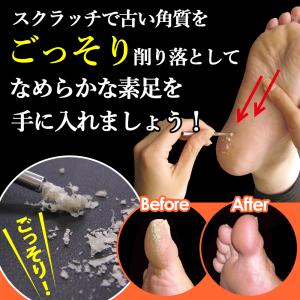 魚の目 取り方 自分で スクラッチ 角質除去 ...の詳細画像4