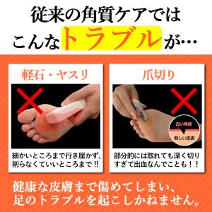 魚の目 取り方 自分で スクラッチ 角質除去 ...の詳細画像5