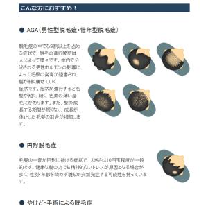 スーパーミリオンヘアー トライアルセット No...の詳細画像2